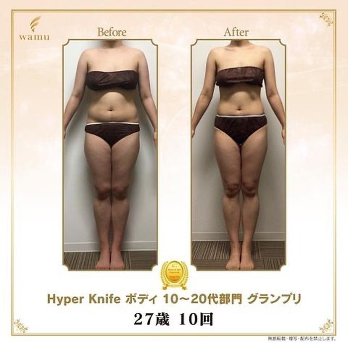 画像314
