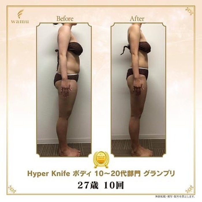 画像315