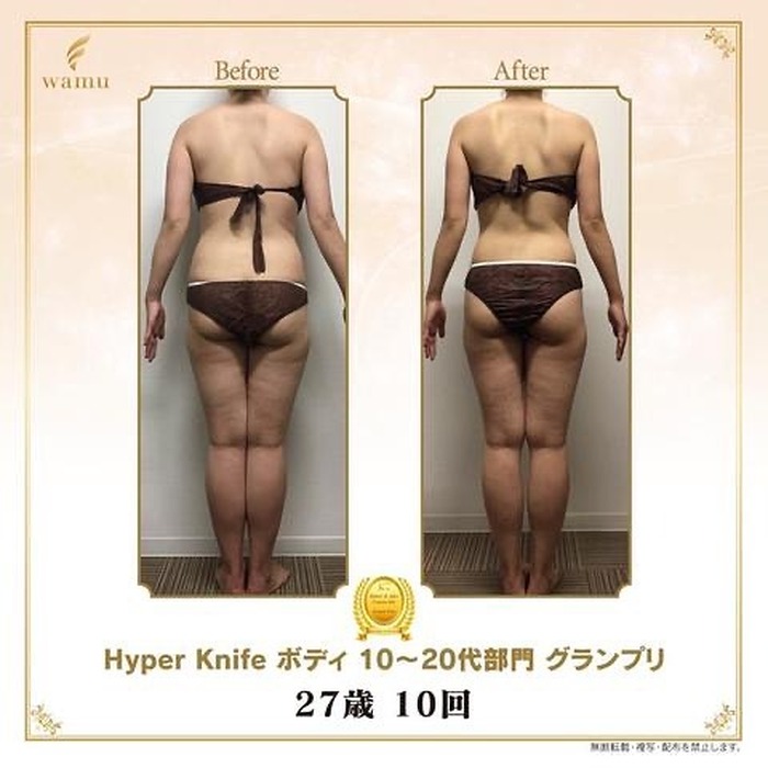 画像316