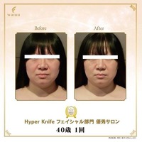 画像343